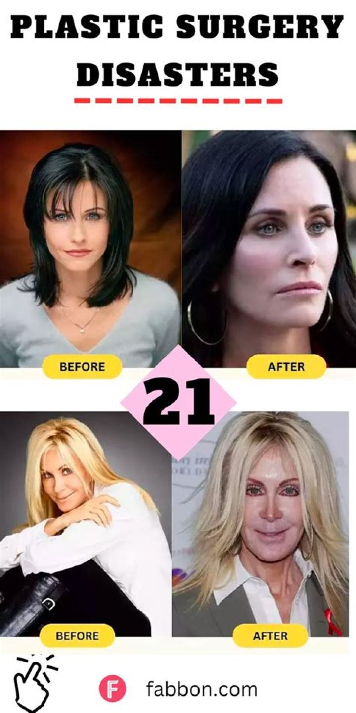 Discoveries From Before Plastic Surgery