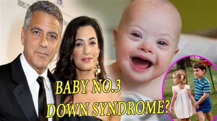 Down Syndrome And The Clooney Twins