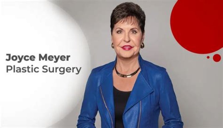 Joyce Meyer's Plastic Surgery Journey: Uncovering Truth And Insights