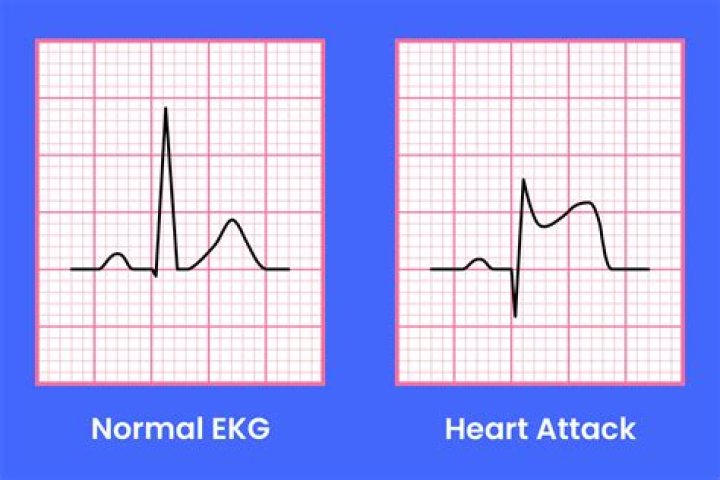 Les Gold's Heart Attack And Its Impact