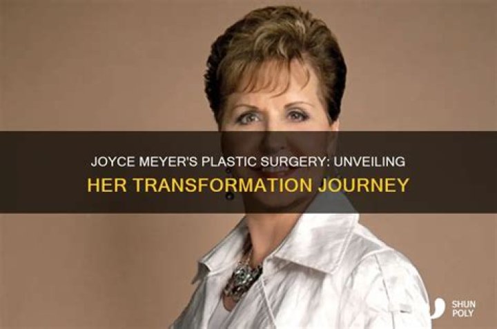 Unveiling Joyce Meyer's Plastic Surgery Journey: Before And After Insights