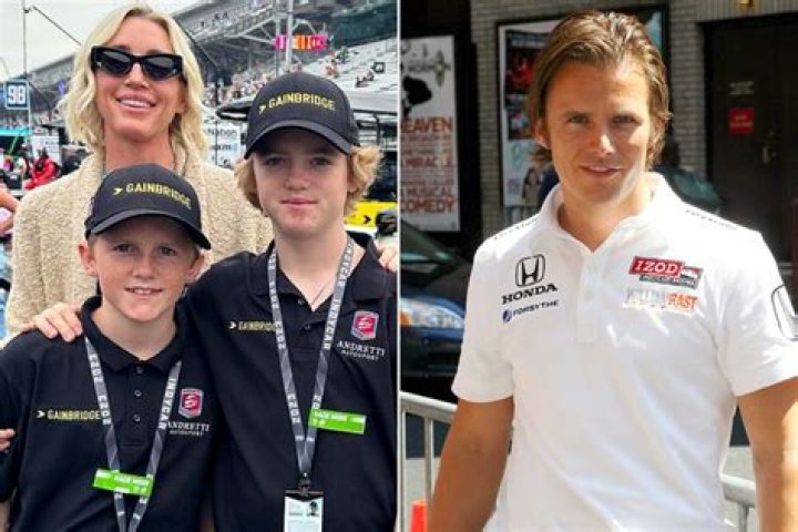 Unveiling The Secrets Of Susie Wheldon's Plastic Surgery Journey